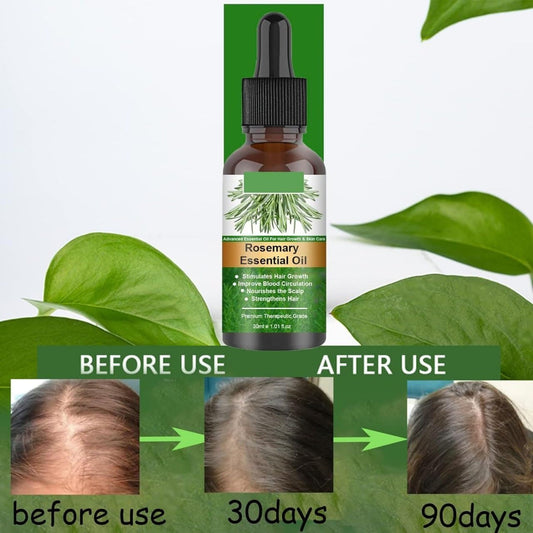 EELHOE Rosemary Essential Oil 30ml/Promote Hair growth.